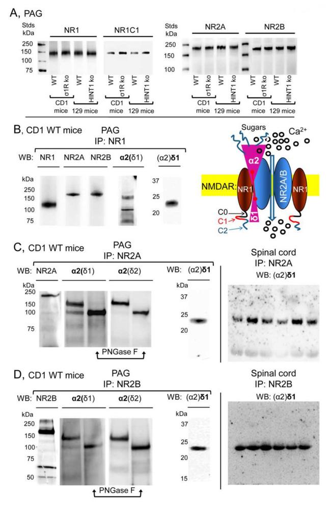 NMDAR2B Antibody in Western Blot (WB)