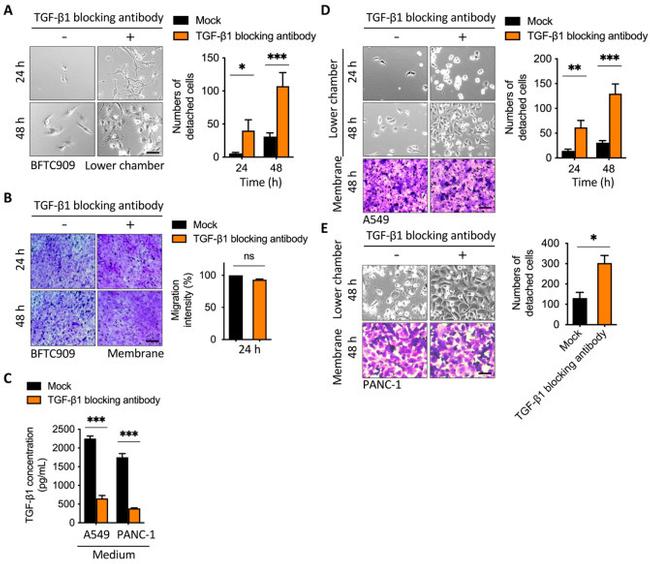 TGF beta-1,2,3 Antibody in Neutralization (Neu)