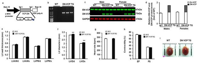 VCP Antibody in Western Blot (WB)