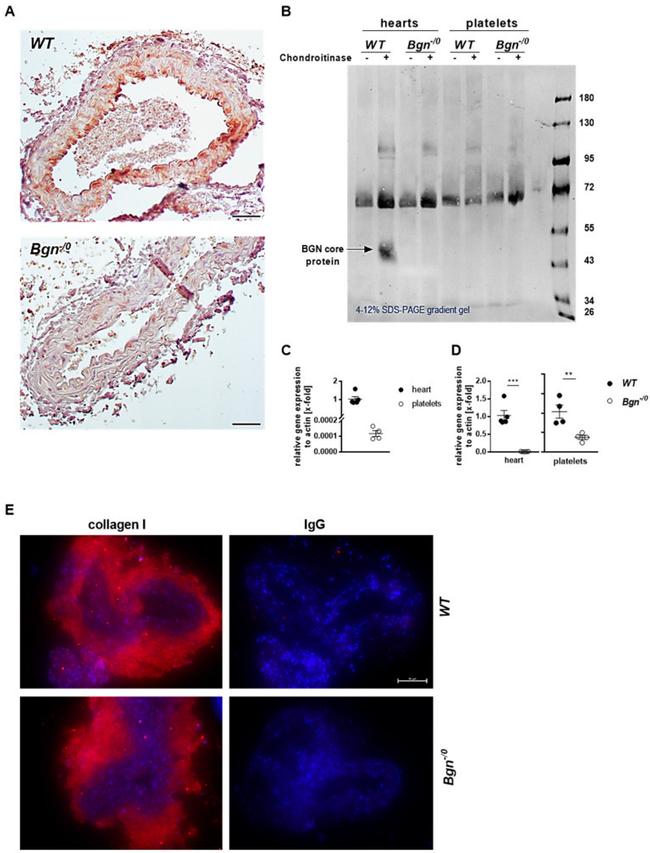 Collagen I Antibody in Immunohistochemistry (IHC)