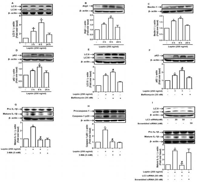 ATG5 Antibody in Western Blot (WB)