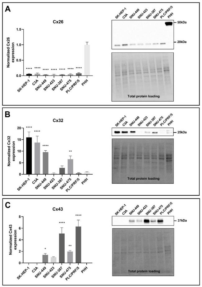 Connexin 26 Antibody in Western Blot (WB)