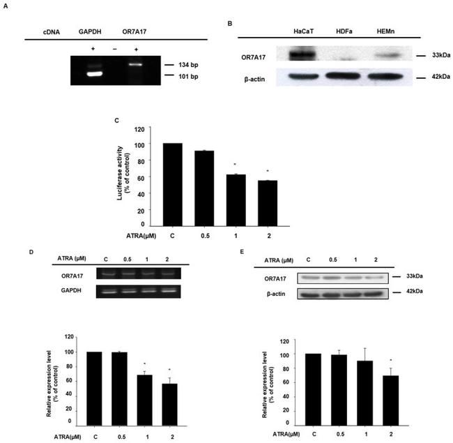 OR7A17 Antibody in Western Blot (WB)