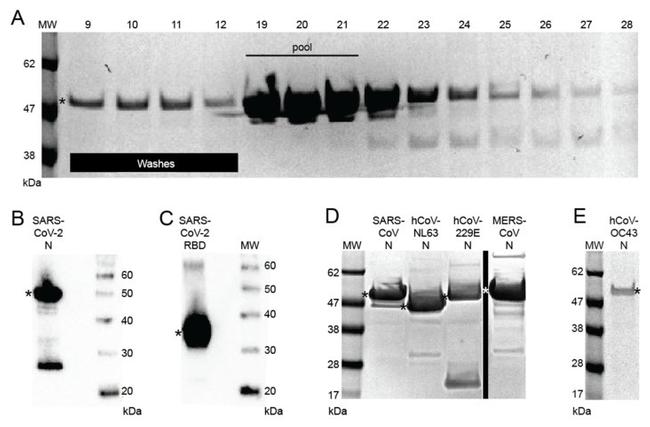 MERS Coronavirus Spike Protein Antibody in Western Blot (WB)