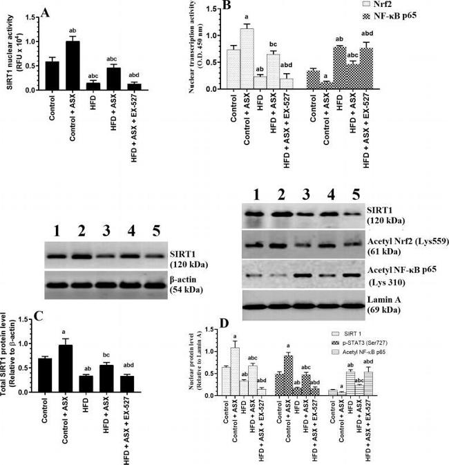 Acetyl-NFkB p65 (Lys310) Antibody in Western Blot (WB)