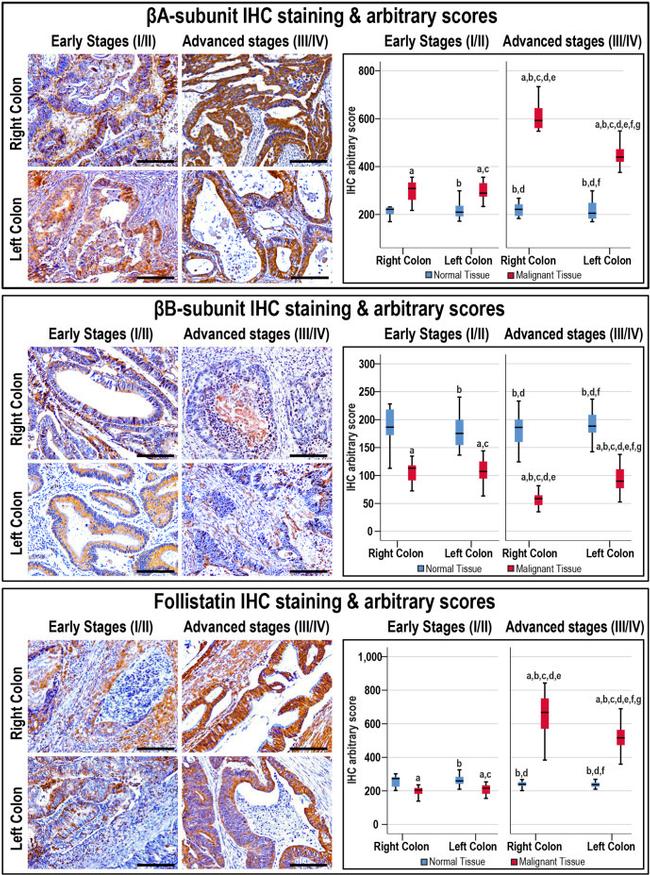 Follistatin Antibody in Immunohistochemistry (IHC)