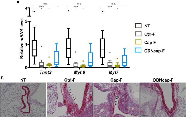 Cardiac Troponin T Antibody in Immunohistochemistry (IHC)