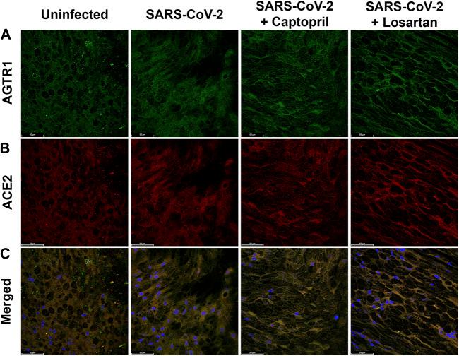 AGTR1 Antibody in Immunocytochemistry (ICC/IF)