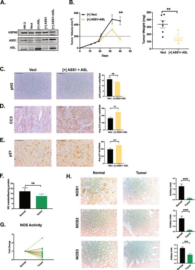 iNOS Antibody in Immunohistochemistry (IHC)