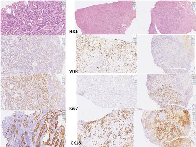 VDR Antibody in Immunohistochemistry (IHC)