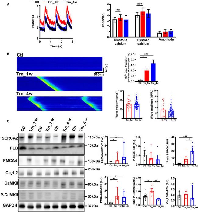 Phospholamban Antibody in Western Blot (WB)