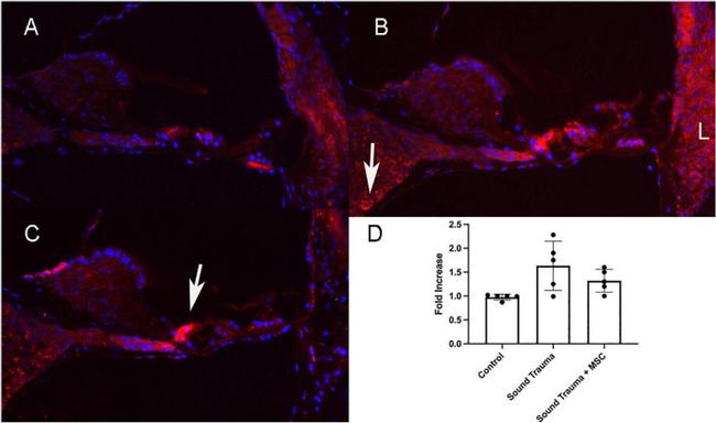 TNF alpha Antibody in Immunohistochemistry (IHC)