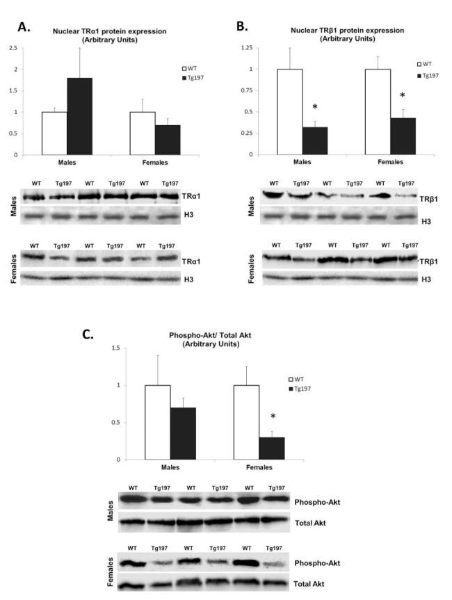 THRB Antibody in Western Blot (WB)