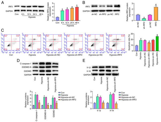 IL-18 Antibody in Western Blot (WB)