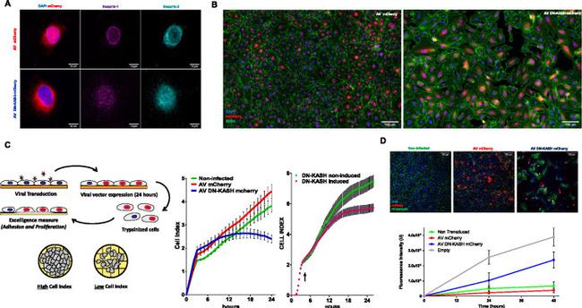 Nesprin 1 Antibody in Immunocytochemistry (ICC/IF)