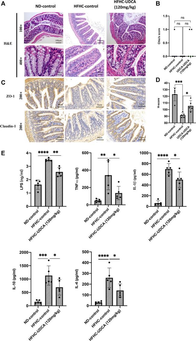 ZO-1 Antibody in Immunohistochemistry (IHC)