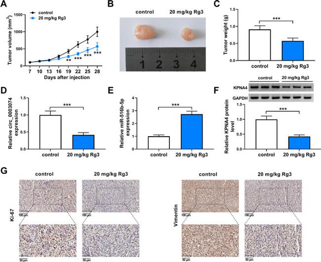 Vimentin Antibody in Immunohistochemistry (IHC)