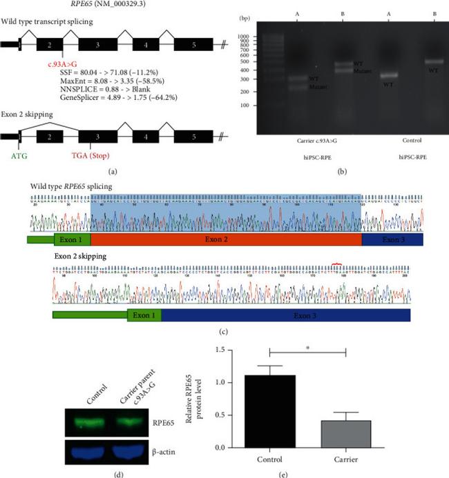 RPE65 Antibody in Western Blot (WB)