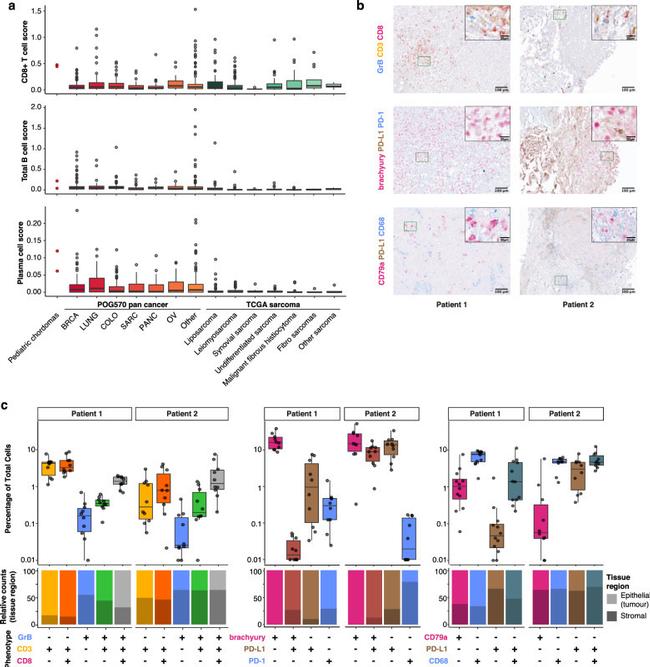 Granzyme B Antibody in Immunohistochemistry (IHC)