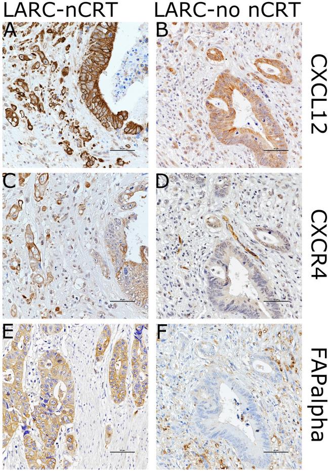 CXCL12 Antibody in Immunohistochemistry (IHC)