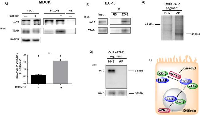 ZO-2 Antibody in Western Blot, Immunoprecipitation (WB, IP)