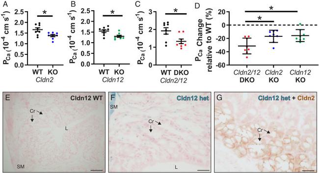 Claudin 2 Antibody in Immunohistochemistry (IHC)