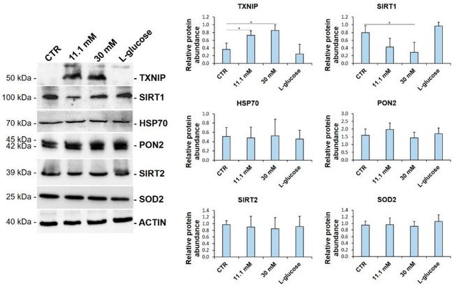 SIRT1 Antibody in Western Blot (WB)