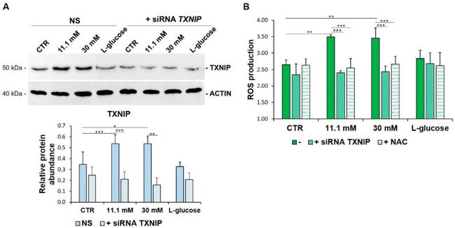 TXNIP Antibody in Western Blot (WB)