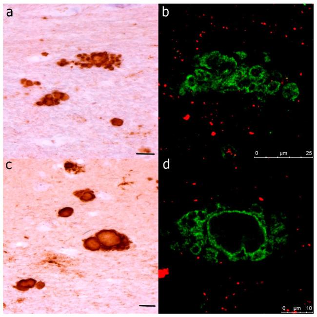 CD230 (PrP) Antibody in Immunohistochemistry (IHC)