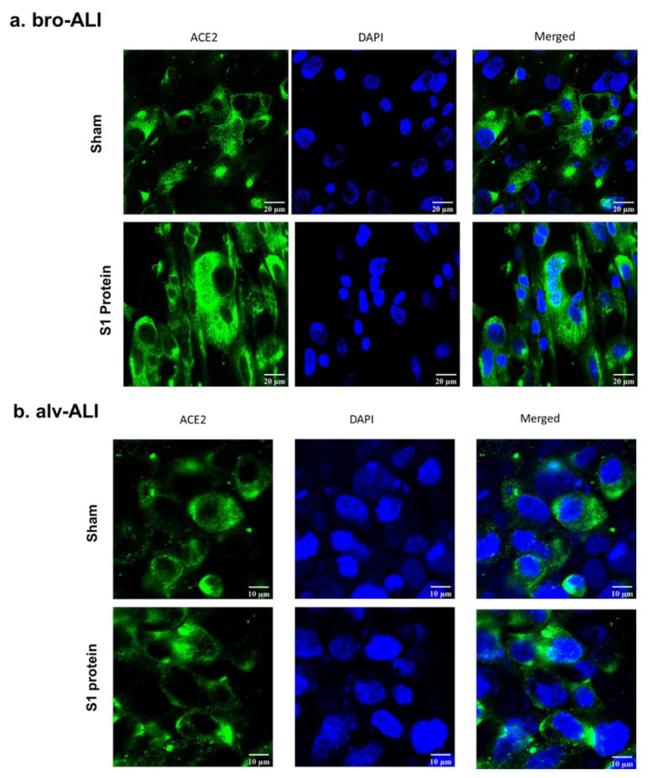 ACE2 Antibody in Immunocytochemistry (ICC/IF)