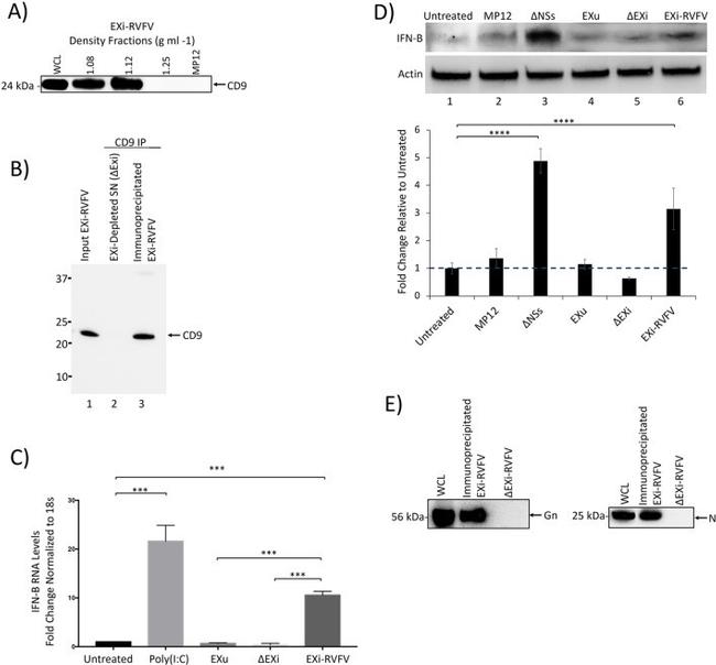 CD9 Antibody in Western Blot, Immunoprecipitation (WB, IP)