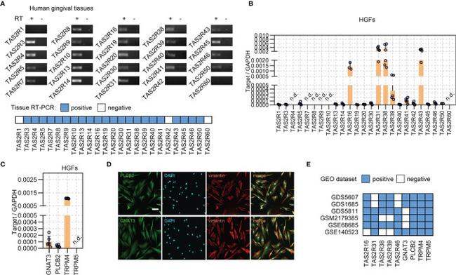 GNAT3 Antibody in Immunohistochemistry (IHC)