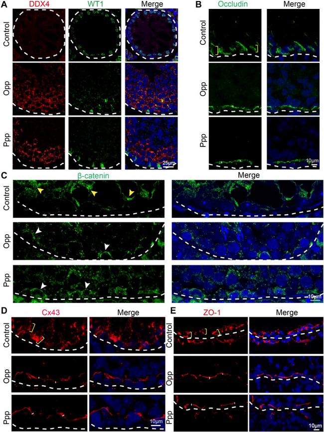 beta Catenin Antibody in Immunohistochemistry (IHC)