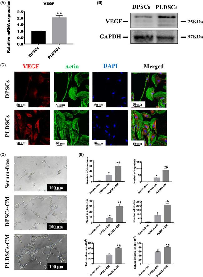 VEGF Antibody in Western Blot (WB)