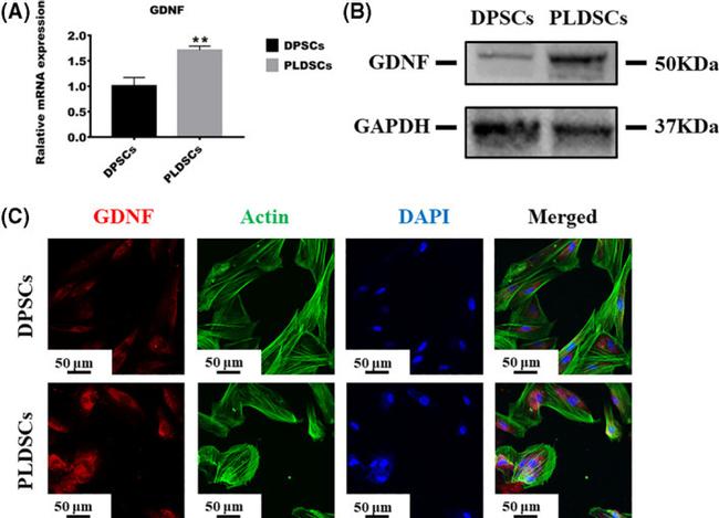 GDNF Antibody in Western Blot (WB)