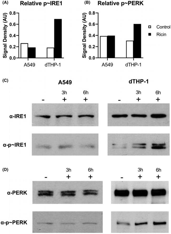 Phospho-IRE1 alpha (Ser724) Antibody in Western Blot (WB)