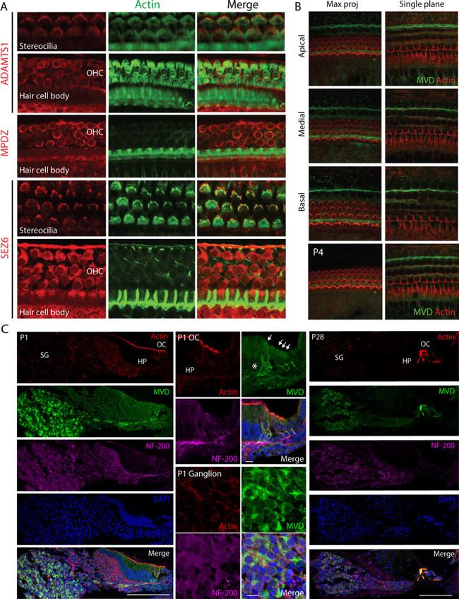 MUPP1 Antibody in Immunohistochemistry (IHC)