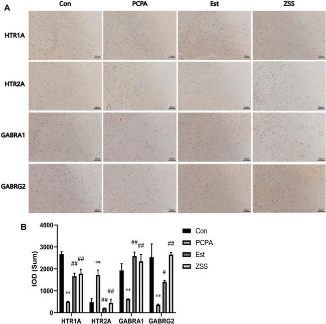 HTR1A Antibody in Immunohistochemistry (IHC)