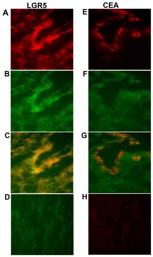 LGR5 Antibody in Immunohistochemistry (IHC)