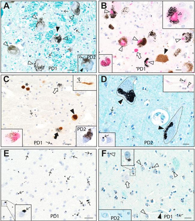 alpha Synuclein Antibody in Immunohistochemistry (IHC)