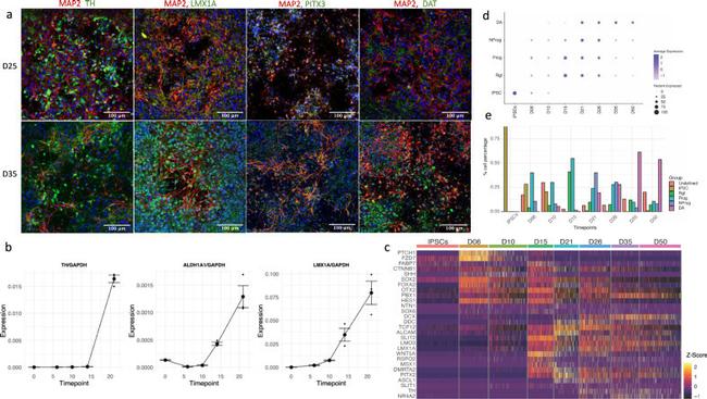 Dopamine Transporter Antibody in Immunohistochemistry (IHC)