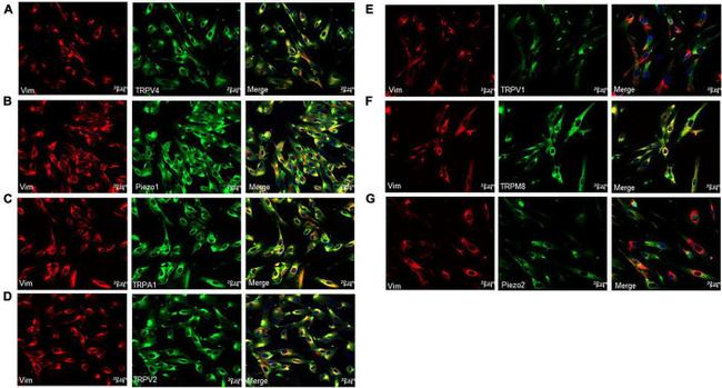 Vimentin Antibody in Immunohistochemistry (IHC)