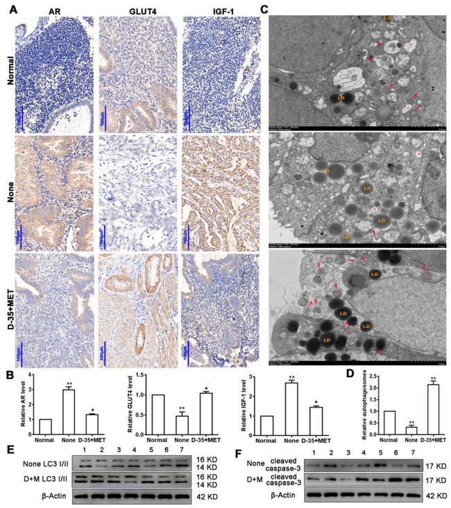 GLUT4 Antibody in Immunohistochemistry (IHC)