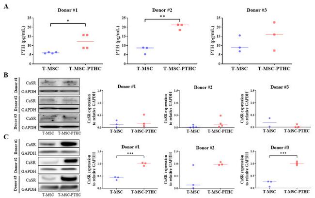 Calcium Sensing Receptor Antibody in Western Blot (WB)