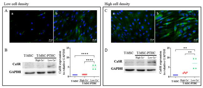 Calcium Sensing Receptor Antibody in Western Blot (WB)