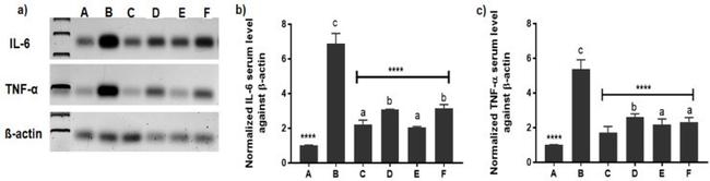 IL-6 Antibody in Western Blot (WB)