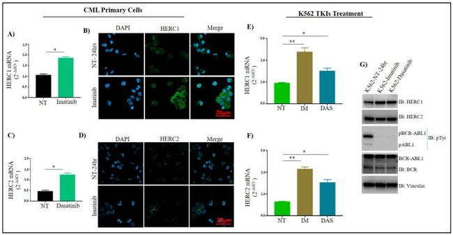 Vinculin Antibody in Western Blot (WB)