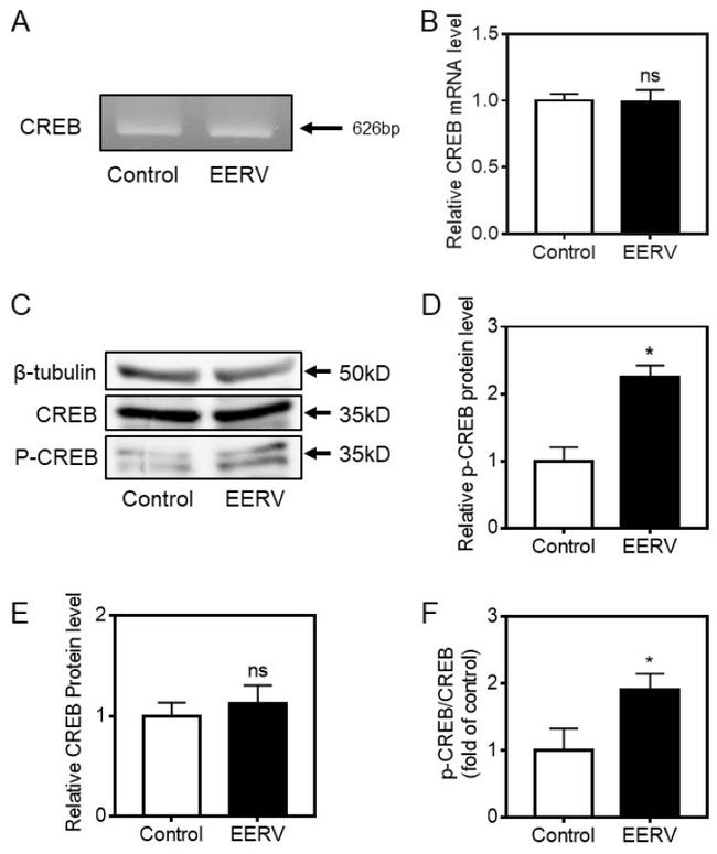 Phospho-CREB (Ser129, Ser133) Antibody in Western Blot (WB)