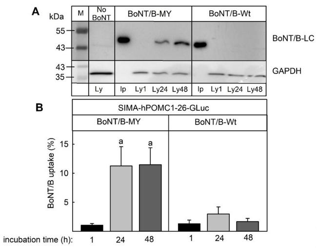 C. botulinum BoNT-B Light Chain Antibody in Western Blot (WB)