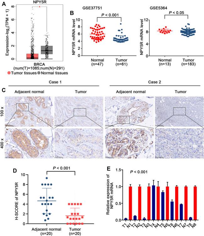 NPY5R Antibody in Immunohistochemistry (IHC)